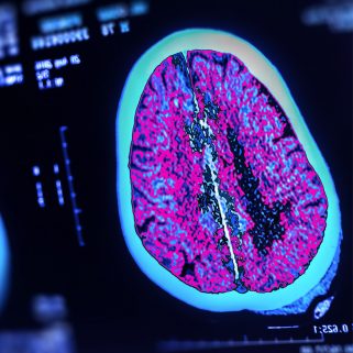 image of brain on screen