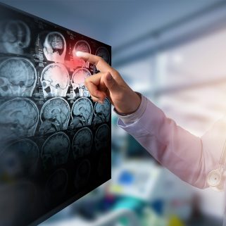 Doctors analysing images of skulls